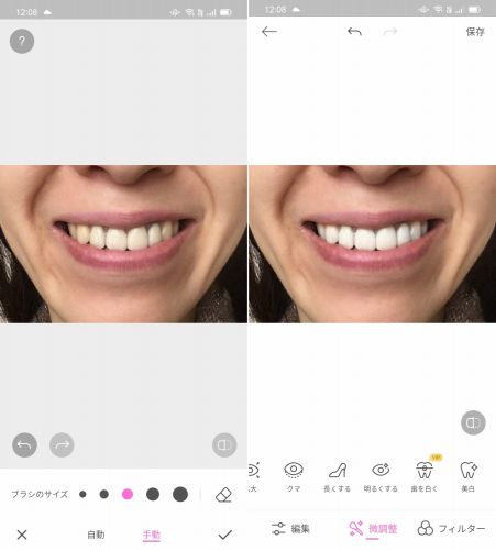 Beauty Camで歯を白くする加工を行った画像